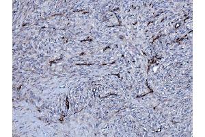 IHC analysis of EHD3 using anti-EHD3 antibody (ABIN7602777). (EHD3 Antikörper  (C-Term))