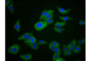 Immunofluorescence staining of HepG2 cells with ABIN7167470 at 1:266, counter-stained with DAPI. (RIPK1 Antikörper  (AA 328-458))