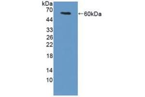 Western blot analysis of recombinant Mouse TGM1. (TGM1 Antikörper  (AA 337-607))