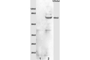 L1 rat brain lysates L2 mouse embryo lysates probed with Anti phospho-Cdc25B (Ser323) Polyclonal Antibody, Unconjugated (ABIN756952) at 1:200 overnight at 4 °C. (CDC25B Antikörper  (pSer323))