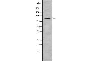 Western blot analysis of ADAM33 using HuvEc whole cell lysates (ADAM33 Antikörper  (Internal Region))