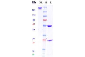 Anti-HGF / SF Reference Antibody (TAK-701) on SDS-PAGE under reducing (R) condition.