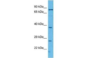 Western Blotting (WB) image for anti-Insulin-Like Growth Factor Binding Protein 4 (IGFBP4) (Middle Region) antibody (ABIN2782316)