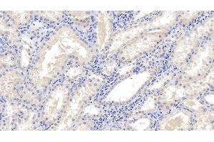 Immunohistochemistry (IHC) image for anti-Microtubule-Associated Protein, RP/EB Family, Member 1 (MAPRE1) (AA 2-268) antibody (ABIN7427183)
