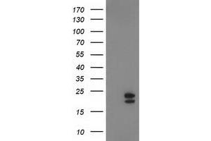 Western Blotting (WB) image for anti-NADH Dehydrogenase (Ubiquinone) 1 beta Subcomplex, 9, 22kDa (NDUFB9) (AA 3-179) antibody (ABIN2727033)