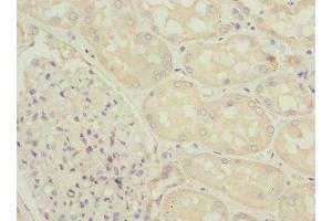 Immunohistochemistry of paraffin-embedded human kidney tissue using ABIN7176063 at dilution of 1:100 (ZFYVE16 Antikörper  (AA 1-280))