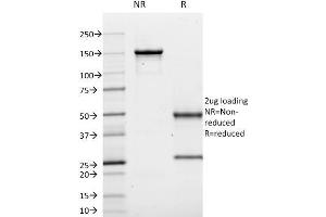 SDS-PAGE Analysis Purified CD10 Mouse Monoclonal Antibody (MME/1620). (MME Antikörper)
