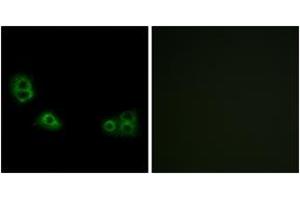 Immunofluorescence analysis of MCF7 cells, using TMEM185A Antibody. (TMEM185A Antikörper  (AA 290-339))