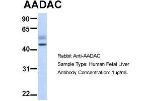 Host:  Rabbit  Target Name:  AADAC  Sample Type:  Human Fetal Liver  Antibody Dilution:  1. (AADAC Antikörper  (N-Term))