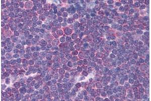 Immunohistochemistry (Paraffin-embedded Sections) (IHC (p)) image for anti-Cholinergic Receptor, Nicotinic, alpha 3 (Neuronal) (CHRNA3) (AA 26-75) antibody (ABIN6736366)