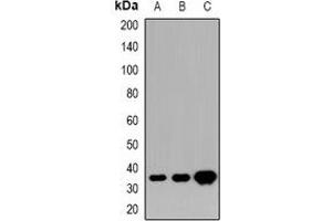 Western blot analysis of HOXD13 expression in U87MG (A), mouse brain (B), rat brain (C) whole cell lysates. (Homeobox D13 Antikörper)