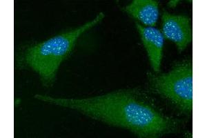 ICC/IF analysis of FADD in HeLa cells line, stained with DAPI (Blue) for nucleus staining and monoclonal anti-human FADD antibody (1:100) with goat anti-mouse IgG-Alexa fluor 488 conjugate (Green). (FADD Antikörper  (AA 1-208))