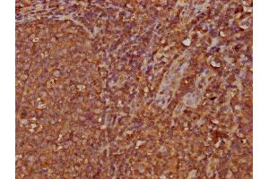 IHC image of ABIN7156081 diluted at 1:300 and staining in paraffin-embedded human tonsil tissue performed on a Leica BondTM system. (IGHA2 Antikörper  (AA 36-111))