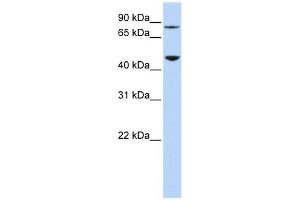 DPH2 antibody used at 1 ug/ml to detect target protein. (DPH2 Antikörper)