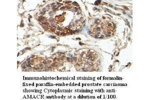 Image no. 1 for anti-alpha-Methylacyl-CoA Racemase (AMACR) antibody (ABIN791220) (AMACR Antikörper)