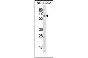 Western Blotting (WB) image for anti-Membrane-Bound Transcription Factor Peptidase, Site 2 (MBTPS2) (AA 14-44), (N-Term) antibody (ABIN953342)