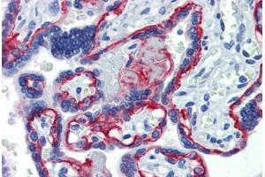 Placenta, Human: Formalin-Fixed, Paraffin-Embedded (FFPE) (Integrin beta 4 Antikörper)