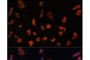 Immunofluorescence analysis of L929 cells using TMEM25 Polyclonal Antibody at dilution of 1:100. (TMEM25 Antikörper)