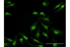 Immunofluorescence of purified MaxPab antibody to DDB1 on HeLa cell. (DDB1 Antikörper  (AA 1-1140))