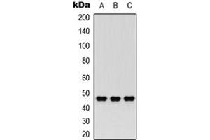 Western blot analysis of Nocturnin expression in HEK293T (A), PC12 (B), HeLa (C) whole cell lysates. (CCRN4L Antikörper  (Center))