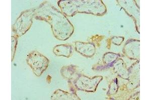 Immunohistochemistry of paraffin-embedded human placenta tissue using ABIN7171193 at dilution of 1:100 (Syndecan 1 Antikörper  (AA 25-240))