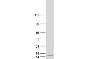 Oxidoreductase Like Domain Containing 1 (OXLD1) protein (Myc-DYKDDDDK Tag)