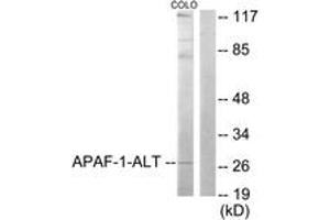 Western blot analysis of extracts from COLO205 cells, using APAF-1-ALT Antibody.