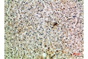 Immunohistochemical analysis of paraffin-embedded human-liver, antibody was diluted at 1:200 (TNIP2 Antikörper  (AA 61-110))