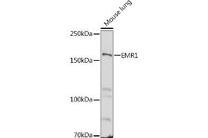 Western Blotting (WB) image for anti-Egf-Like Module Containing, Mucin-Like, Hormone Receptor-Like 1 (EMR1) (AA 21-290) antibody (ABIN3021858)