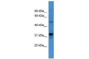 Western Blot showing TMEM176B antibody used at a concentration of 1-2 ug/ml to detect its target protein.