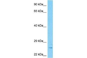 Host:  Rabbit  Target Name:  MBL2  Sample Type:  Stomach Tumor lysates  Antibody Dilution:  1. (MBL2 Antikörper  (N-Term))