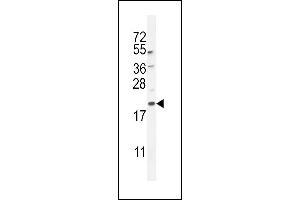 G8a/b (M1LC3A/B) 10648a western blot analysis in mouse lung tissue lysates (35 μg/lane). (MAP1LC3A/B Antikörper  (cleaved))