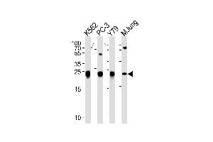 GSTP1 Antibody (Center) (ABIN1881393 and ABIN2842718) western blot analysis in K562,PC-3,Y79 cell line and mouse lung tissue lysates (35 μg/lane).