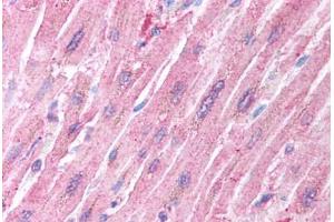 Human Heart (formalin-fixed, paraffin-embedded) stained with CRADD antibody ABIN213922 at 5 ug/ml followed by biotinylated goat anti-rabbit IgG secondary antibody ABIN481713, alkaline phosphatase-streptavidin and chromogen. (CRADD Antikörper  (AA 99-117))