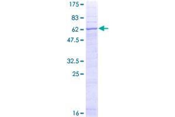 STEAP1 Protein (AA 1-339) (GST tag)