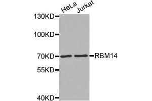 Western Blotting (WB) image for anti-RNA Binding Motif Protein 14 (RBM14) antibody (ABIN1874564) (RBM14 Antikörper)