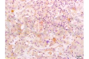 Immunohistochemistry (IHC) image for anti-Insulin-Like Growth Factor Binding Protein 2, 36kDa (IGFBP2) (AA 101-200) antibody (ABIN737781)