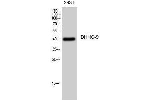 Western Blotting (WB) image for anti-Zinc Finger, DHHC-Type Containing 9 (ZDHHC9) (C-Term) antibody (ABIN3174756) (ZDHHC9 Antikörper  (C-Term))