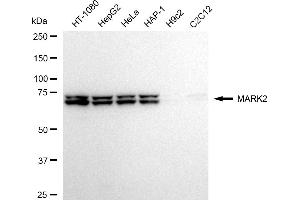 Western blotting analysis using MARK2 antibody (ABIN7799333). (Rekombinanter MARK2 Antikörper)