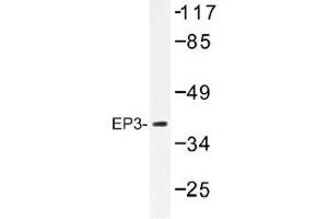 Image no. 1 for anti-Prostaglandin E Receptor 3 (Subtype EP3) (PTGER3) antibody (ABIN317859) (PTGER3 Antikörper)