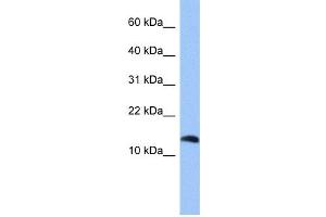 WB Suggested Anti-PTH2 Antibody Titration: 0. (Parathyroid Hormone 2 (PTH2) (Middle Region) Antikörper)