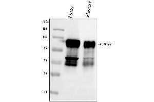 Western blot analysis of Calpastatin using anti-Calpastatin antibody (ABIN4886503). (Calpastatin Antikörper  (Middle Region))