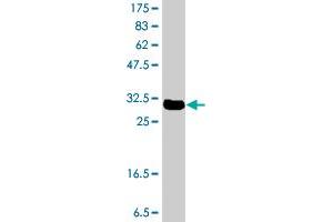 Western Blot detection against Immunogen (32. (KLF2 Antikörper  (AA 1-56))