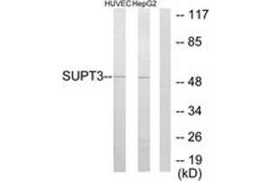 Western blot analysis of extracts from HuvEc/HepG2 cells, using SUPT3H Antibody. (SUPT3H/SPT3 Antikörper  (AA 171-220))