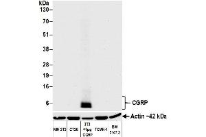Western Blotting (WB) image for anti-Calcitonin-Related Polypeptide alpha (CALCA) (AA 75-125) antibody (ABIN7452578)