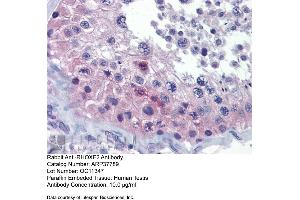 Human Testis (RHOXF2 Antikörper  (Middle Region))