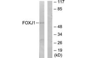 Western blot analysis of extracts from LOVO cells, using FOXJ1 Antibody.