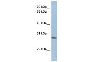 NANP antibody used at 1 ug/ml to detect target protein. (NANP Antikörper  (Middle Region))