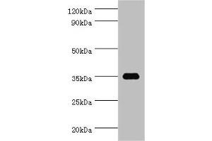 Western blot All lanes: SULT1C2 antibody at 5 μg/mL + Hela whole cell lysate Secondary Goat polyclonal to rabbit IgG at 1/10000 dilution Predicted band size: 35, 36 kDa Observed band size: 35 kDa (SULT1C2 Antikörper  (AA 1-120))
