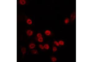 ABIN6266726 staining HT29 by IF/ICC. (TAF5L Antikörper  (Internal Region))
